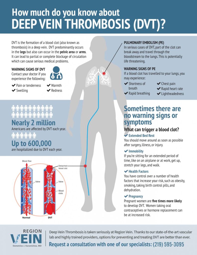 Region Vein DVT Infographic scaled 2