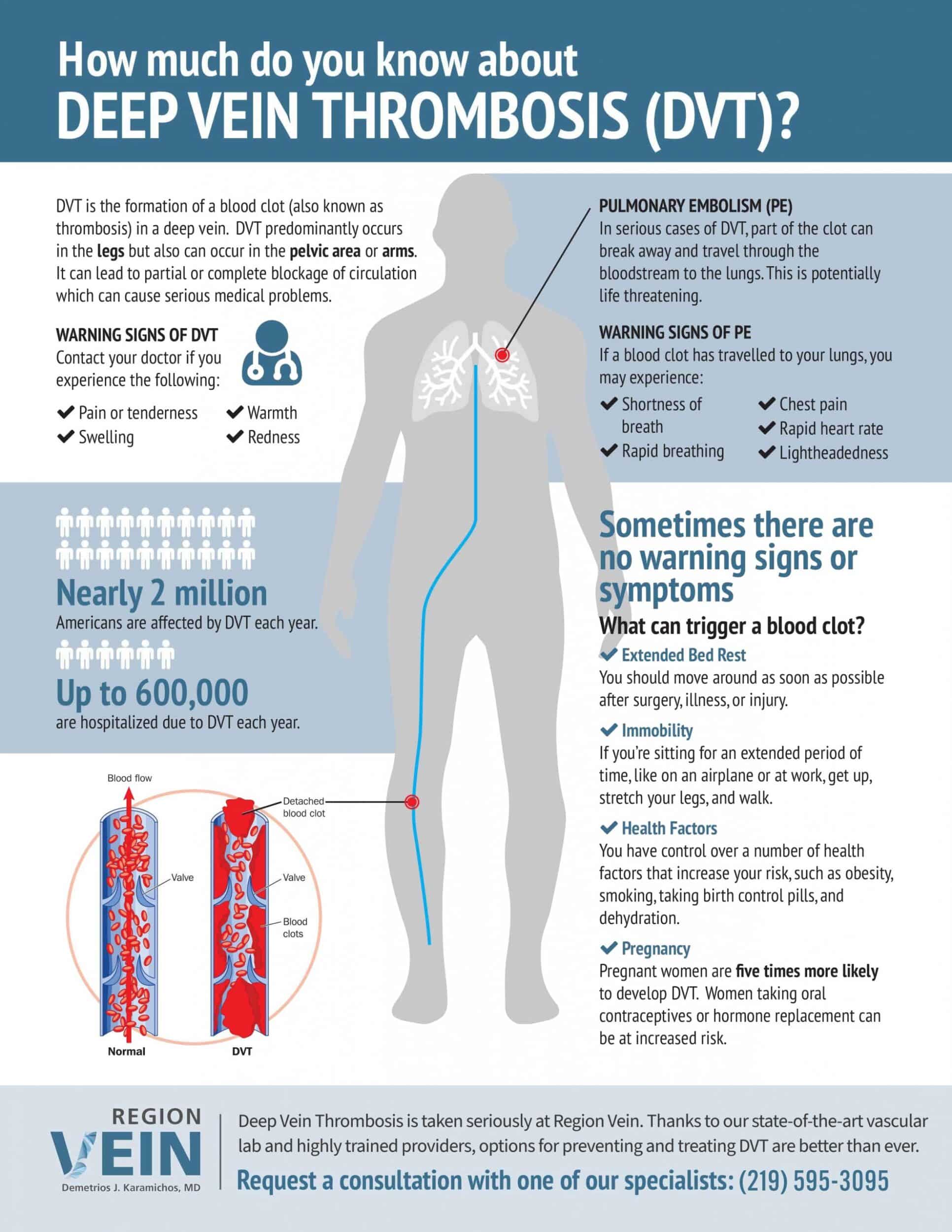 Dvt Prevention: Crucial After Your Icd Procedure - s55dzul