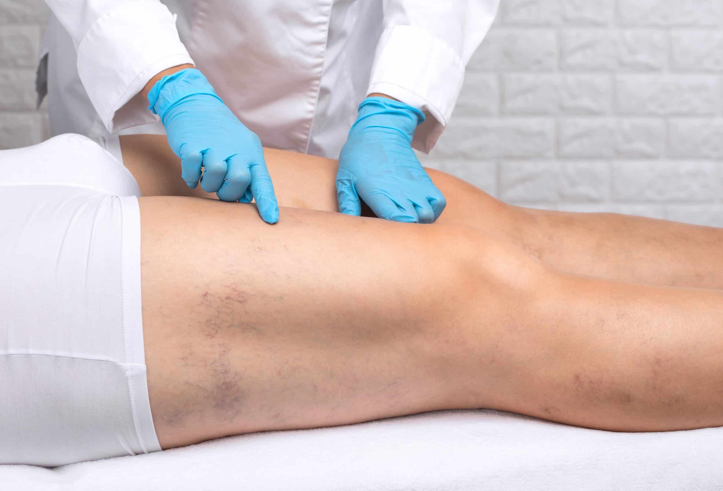 Doctor examines a woman's legs, looking for the cause of her venous ulcers