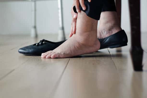 Leg & Ankle Swelling Treatment in Munster, IN